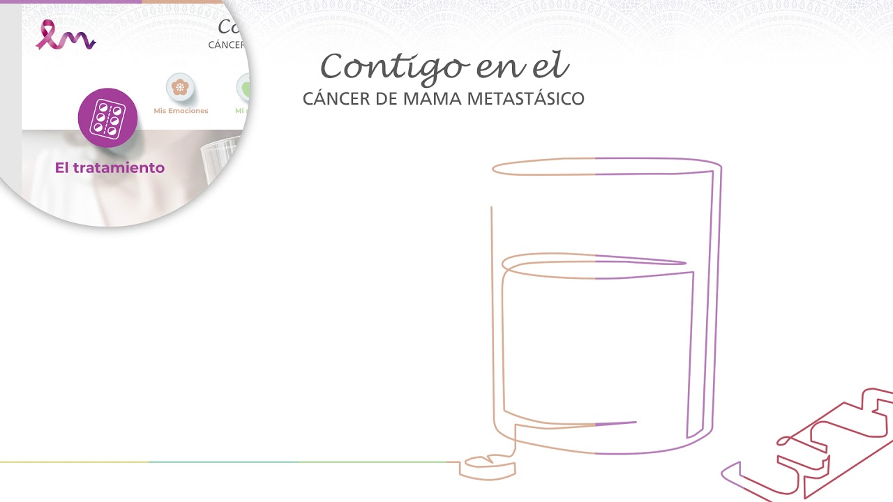 españa nueva Contigo en el cáncer de mama metastásico: el tratamiento