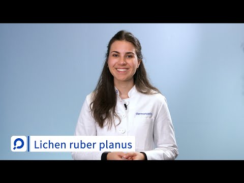 Video: Lichen Planus: Symptome, Diagnose, Behandlung Und Risiken