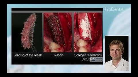 Geistlich-DMM webinar Dr. Marcus Seiler - YxossCBR
