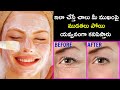 How to Remove Wrinkles on Face || Remove Wrinkles || ఇలా&#39;చేస్తే ముఖం పై ముడతలు మాయం || Beauty Tips