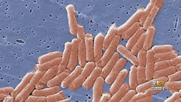 Red Onions Linked To Salmonella Outbreak That Has Sickened People In 31 States, Including Maryland