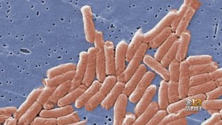Red Onions Linked To Salmonella Outbreak That Has Sickened People In 31 States, Including Maryland