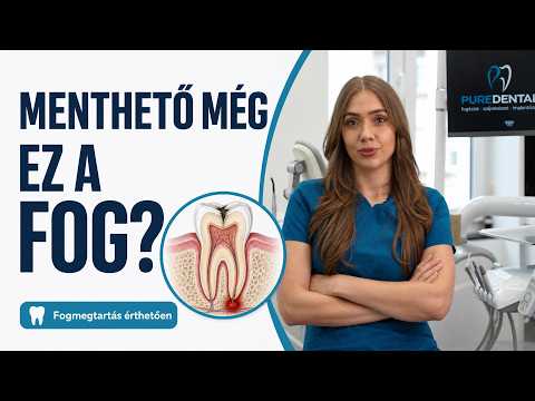Mikor kell egy fogat eltávolítani, és mikor menthető még? – PureDental videótár