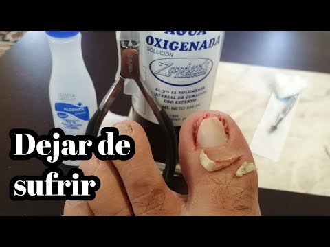 Vídeo: Como Sacar Wmr