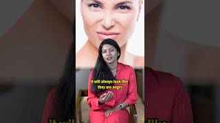 Angry face even when you are not angry #beauty #angryface #nose #rhinoplasty #plasticsurgery