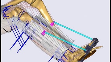 [SOLEUS] Musculoskeletal Simulation of Countermeasure Exercise in Space