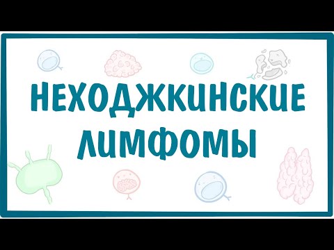 Неходжкинские лимфомы — причины, симптомы, патогенез, диагностика, лечение