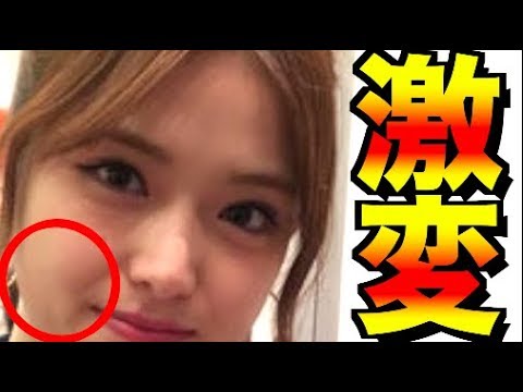 【乃木坂46】 松村沙友理ことさゆりんごのある場所のイジリの真相が!? ファンの人達はどう思う？