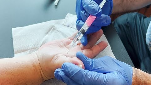 Tigger Finger Injection