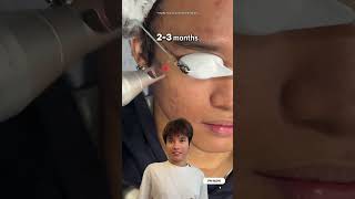 Download Lagu Used the wrong products and ended up with pimple crisis? 🚨😱 MP3