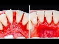 30 MUST-KNOW TEETH HACKS