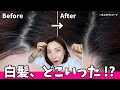 【セルフ白髪ケアここまできた!】最近!44歳のちらほら白髪事情<カラートリートメント>