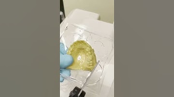 Making Whitening Trays at the Dental Lab | In Office to Hands On Dental Training