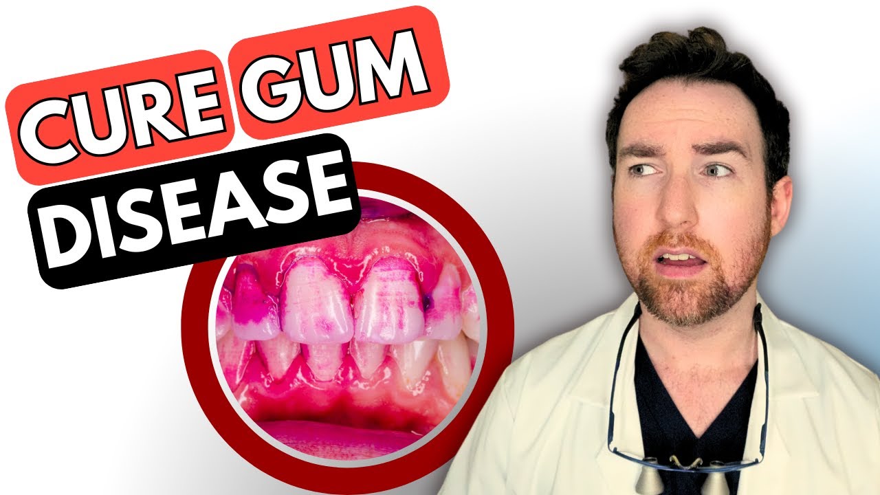 Disclosing Tablets: Remove dental plaque Easier