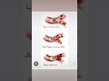 الانيميا المنجليه Sickle Cell Disease 
