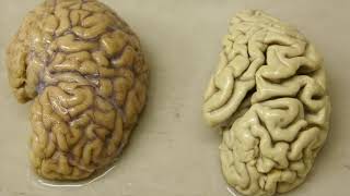 Increase Time For Fun And Friends To Improve The Memory Power- How