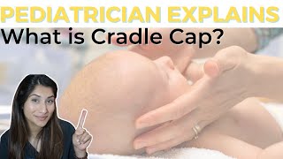 Pediatrician Explains: What is Cradle Cap? | Dr. Amna Husain