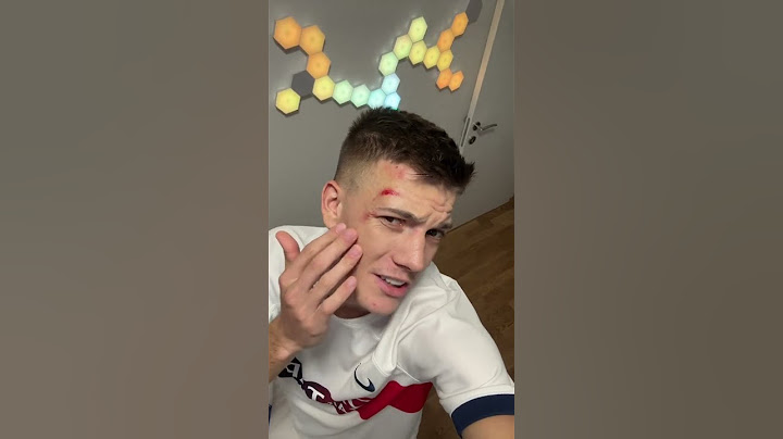 Janko spreman za box match sa Simijem?