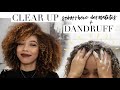 How to Clear Seborrheic Dermatitis & Dry Scalp