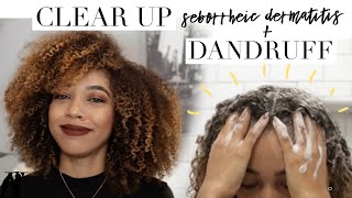 How to Clear Seborrheic Dermatitis &amp; Dry Scalp