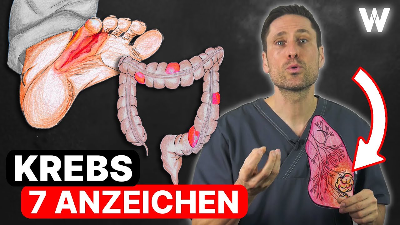 Was ist Krebs und wieso kann ich an einem Tumor versterben? Entstehung, Ausbreitung \u0026 Risikofaktoren