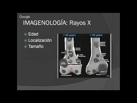 Principios imagenologicos en Oncologia