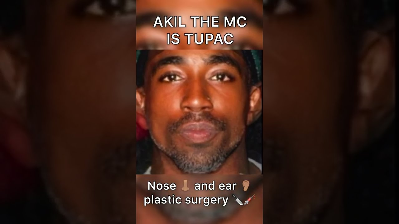 Assista a AKIL THE MC IS 2PAC WITH PLASTIC SURGERY 💉 no YouTube Assista a AKIL THE MC IS 2PAC WITH PLASTIC SURGERY 💉 no YouTube