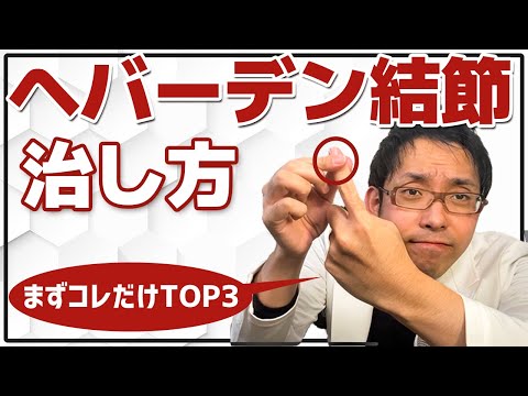 【医師解説】ヘバーデン結節の治療方法TOP3【指の痛み・第一関節】