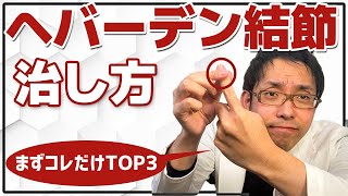 【医師解説】ヘバーデン結節の治療方法TOP3【指の痛み・第一関節】