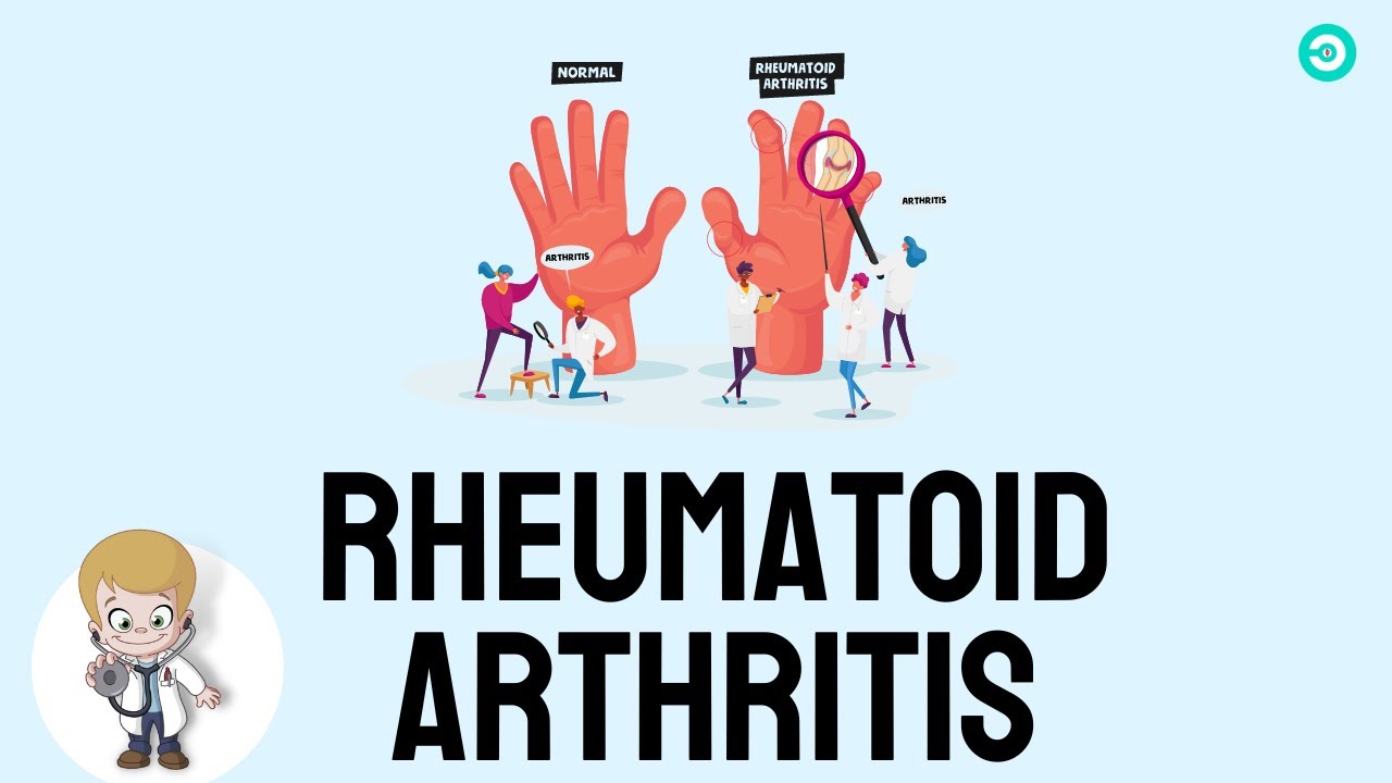 Rheumatoid Arthritis Causes, symptoms and Treatment options YouTube