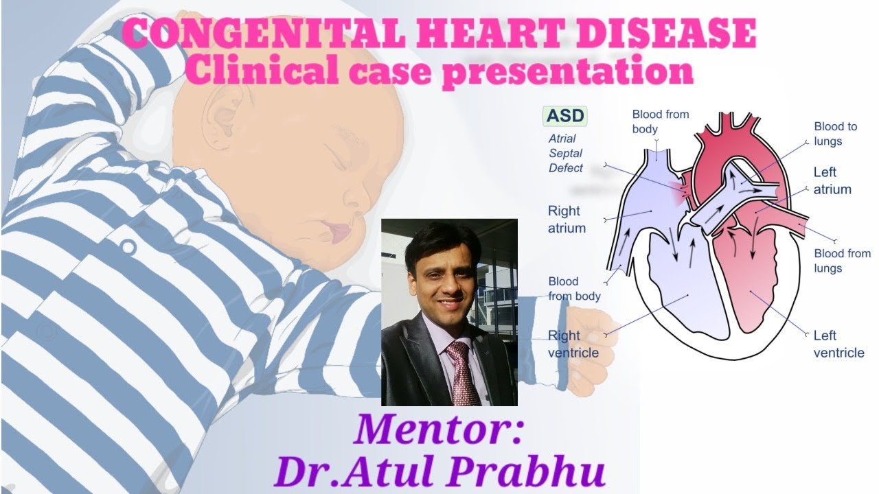 congenital heart disease essay