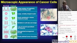 Cancer Basics (Ann Nardulli)