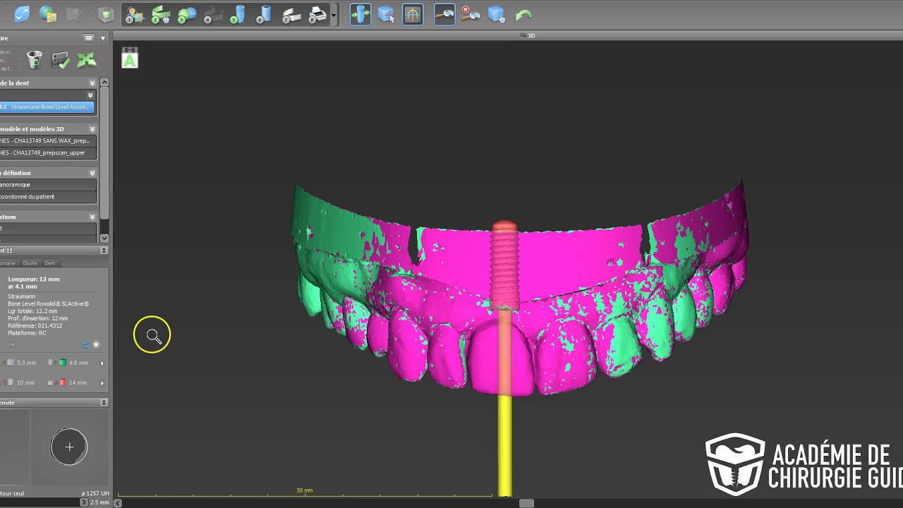Planification avec CoDiagnostix
