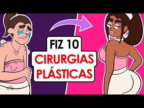 Vídeo: A História Da Cirurgia Plástica De Fakhriye Evgen Ultrajou Os Fãs (VÍDEO)