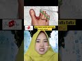 Funny dubbing  kaki kakak infeksi gara gara di gigit lintah  lucu viral shorts