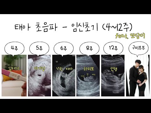   태아 초음파 영상 임신초기 4주 5주 6주 8주 12주 Feat 또담이