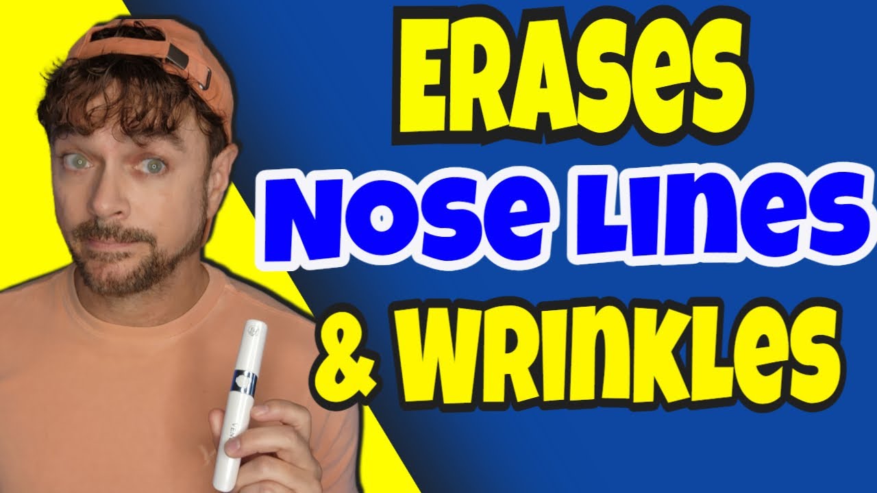 Get Rid Of Nose Bridge Lines (BUNNY LINES) Chris Gibson YouTube