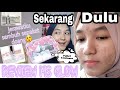 Review skincare MS GLOW buat ilangin jerawat dan bekasnya😍