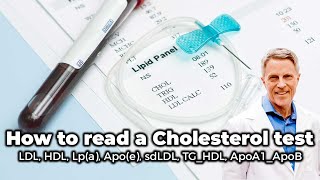How to Read a Cholesterol Test: LDL, HDL, Lp(a), Apo(e), sdLDL, TG/HDL, ApoA1/ApoB