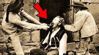 33 BANNED Medicine Facts in Old West So BIZARRE You'll Never Complain About Doctors Again