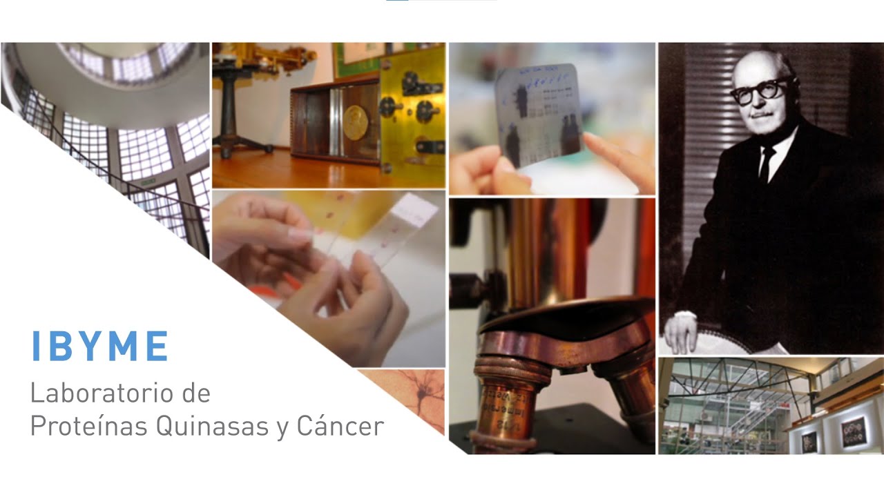 Lab. de Proteínas Quinasas y Cáncer (IBYME)