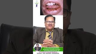 Can You Get Sexually Transmitted Infections from Oral Sex | Best Sexologist in Hyderabad