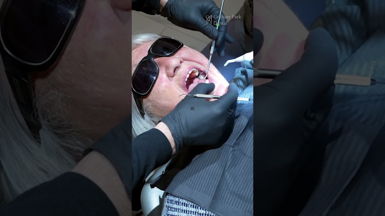 The Shocking Truth About “Perfect” Smiles | What Dentists Won’t Tell You