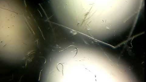 Nematode worm under Raspberry Pi Microscope