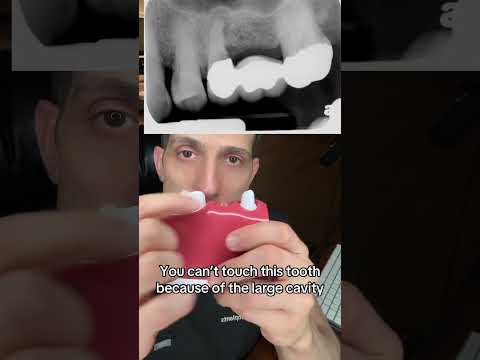 6470294664380708080161 