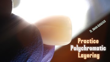 Polychromatic Dental Composite Layering Practice - Exercise 2