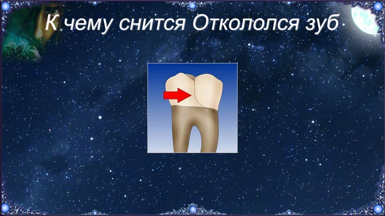 К чему снится Откололся зуб (Сонник)