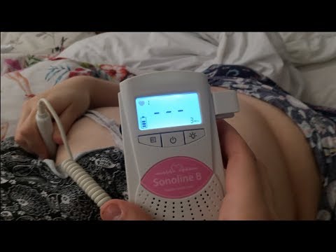 Video: Wat moet fetale hartklop wees op 12 weke?