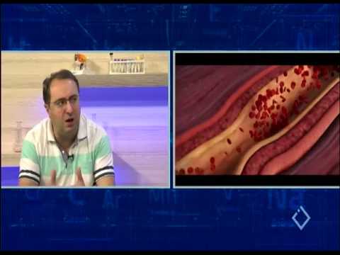 გულის იშემიური დაავადებები - იმპულსი