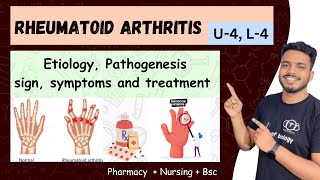 rheumatoid arthritis || rheumatoid arthritis pathophysiology || rheumatoid arthritis nursing #sgsir